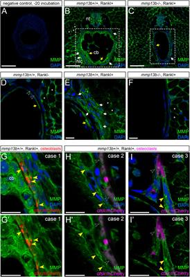 Transcriptome Profiling of Osteoblasts in a Medaka (Oryzias latipes) Osteoporosis Model Identifies Mmp13b as Crucial for Osteoclast Activation